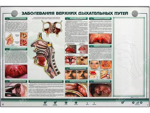 Интерактивный электрифицированный стенд Заболевания верхних дыхательных путей М0064